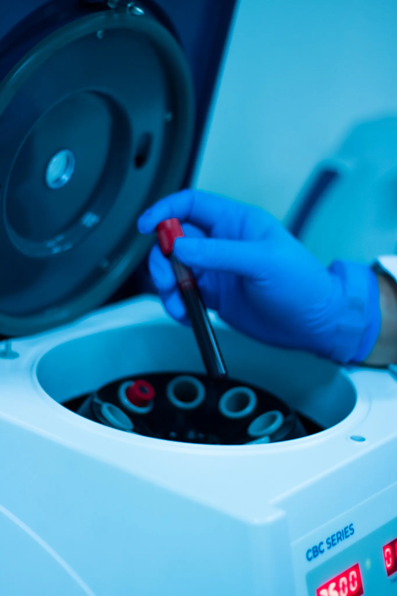 Precisión y rapidez en la entrega de resultados